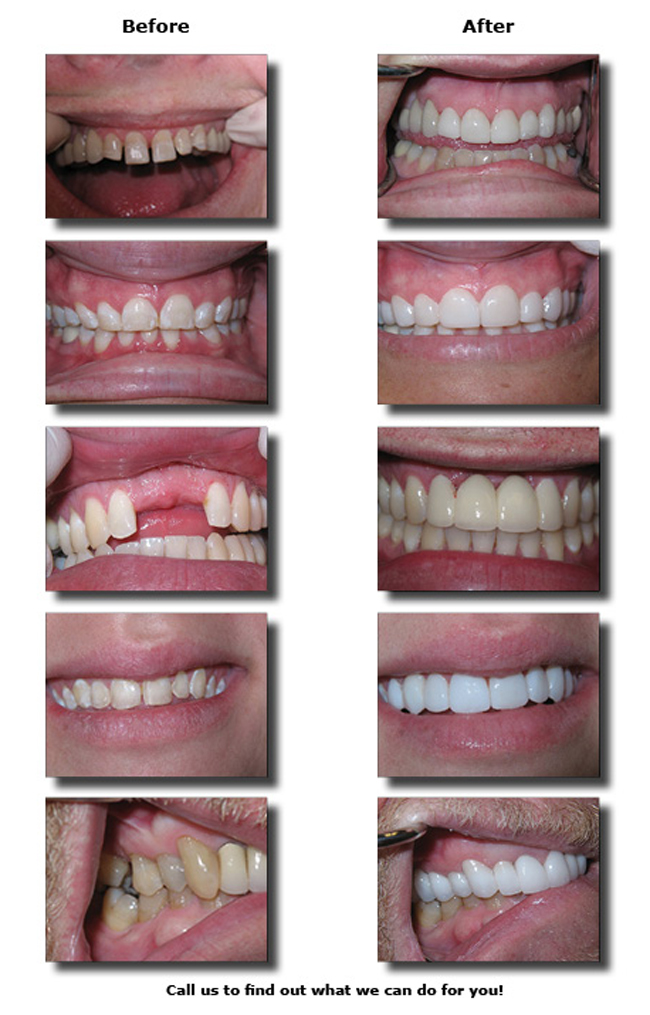 smile gallery